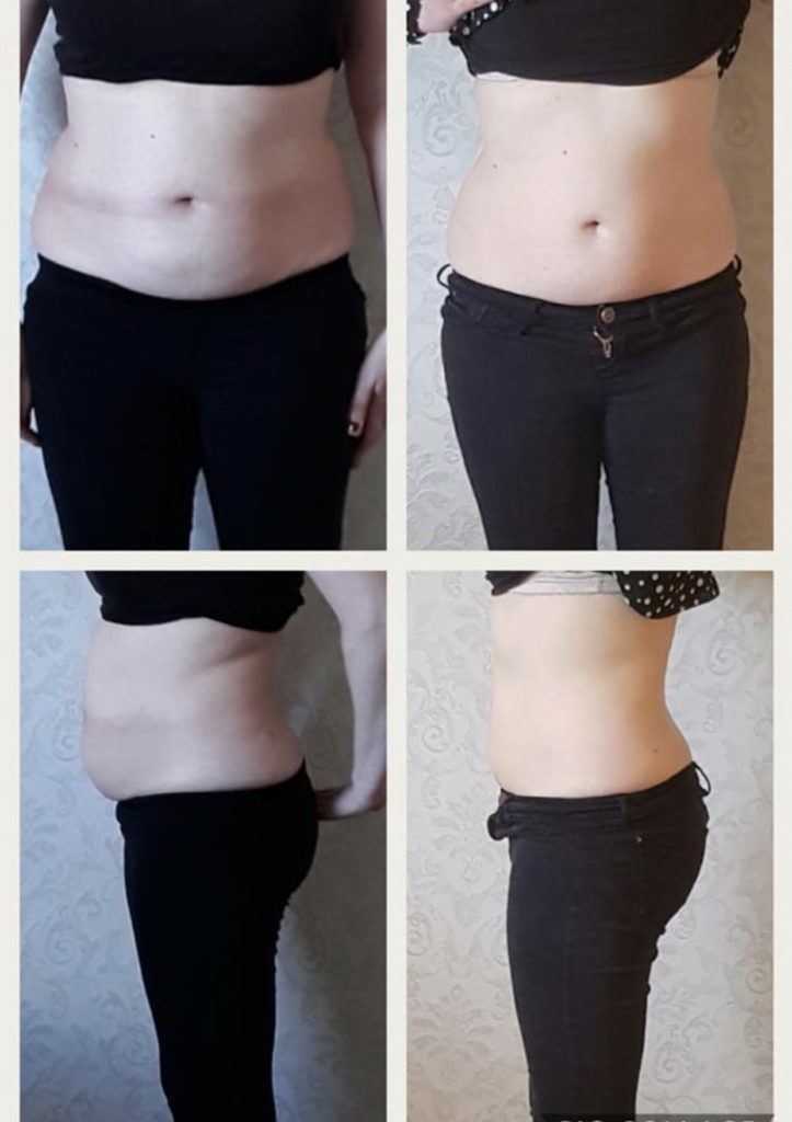 Body sculpting 1 inch loss